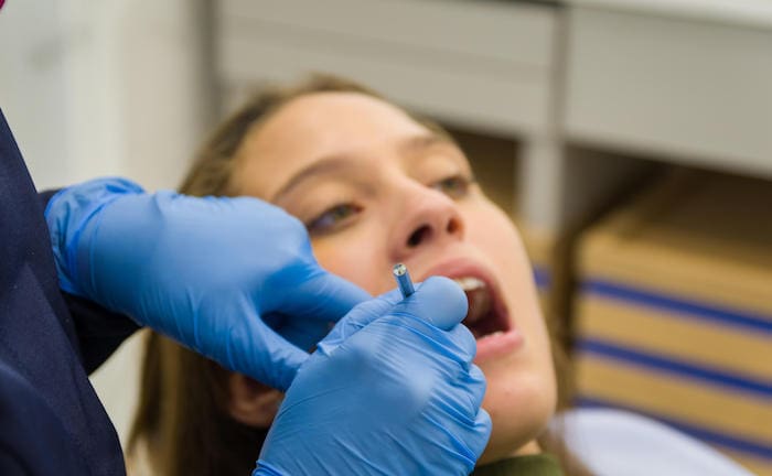 Eine Frau in Behandlung beim Zahnarzt